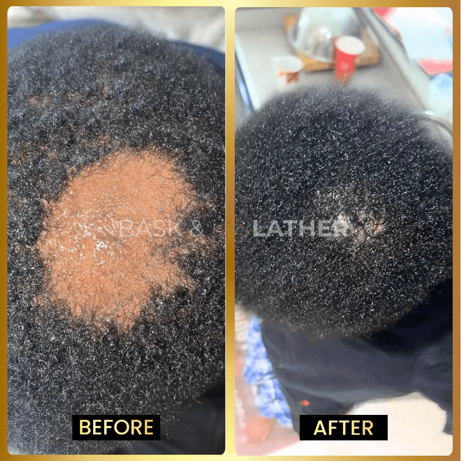 JUMBO Scalp Stimulator